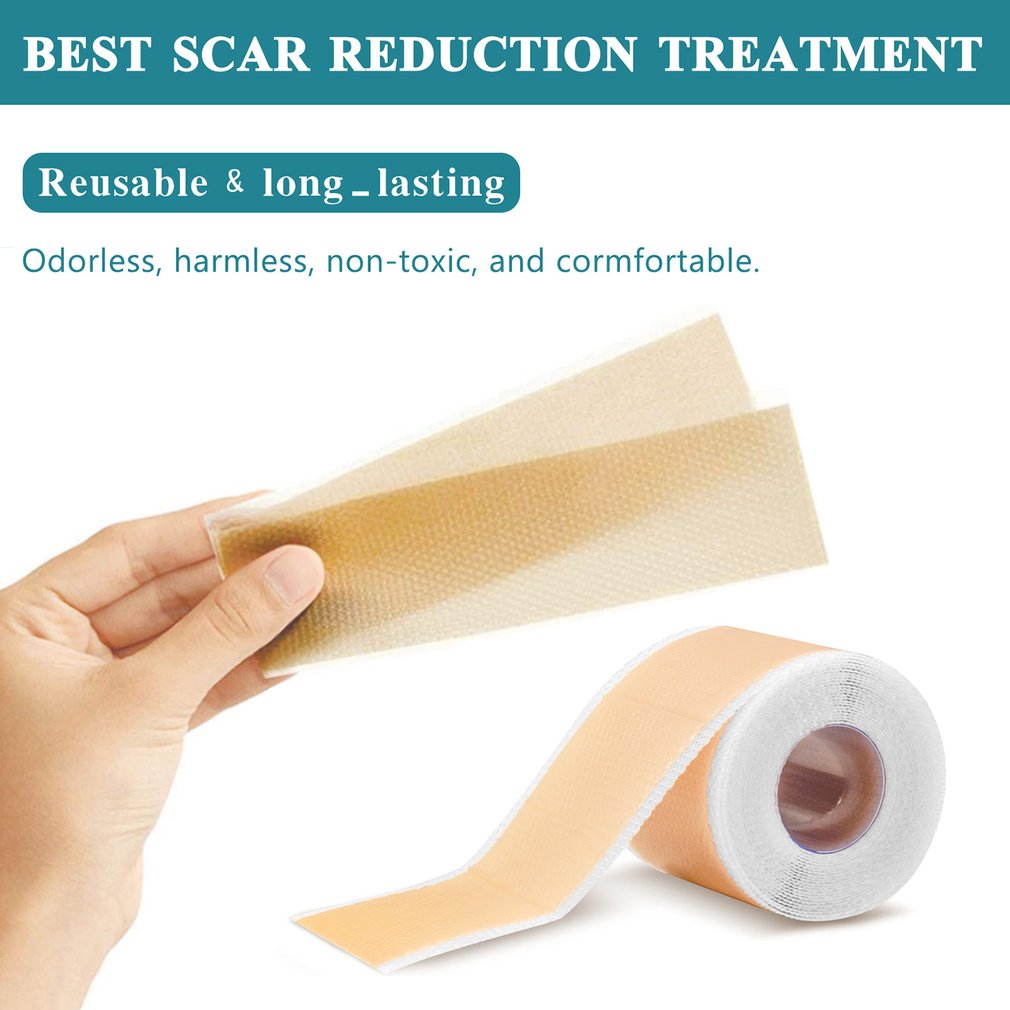 4cm X 150cm 실리콘 흉터 시트, 1롤 자가 접 - Skincare X Beauty 리뷰 및 가격
